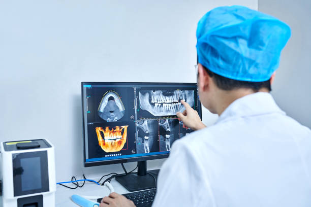 Best Knocked-Out Tooth (Avulsed Tooth) Treatment in Notre Dame, IN